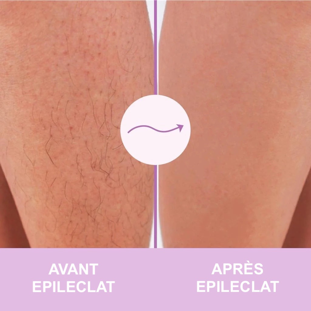 EPILECLAT™ 