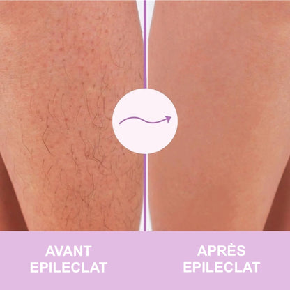 EPILECLAT™ 