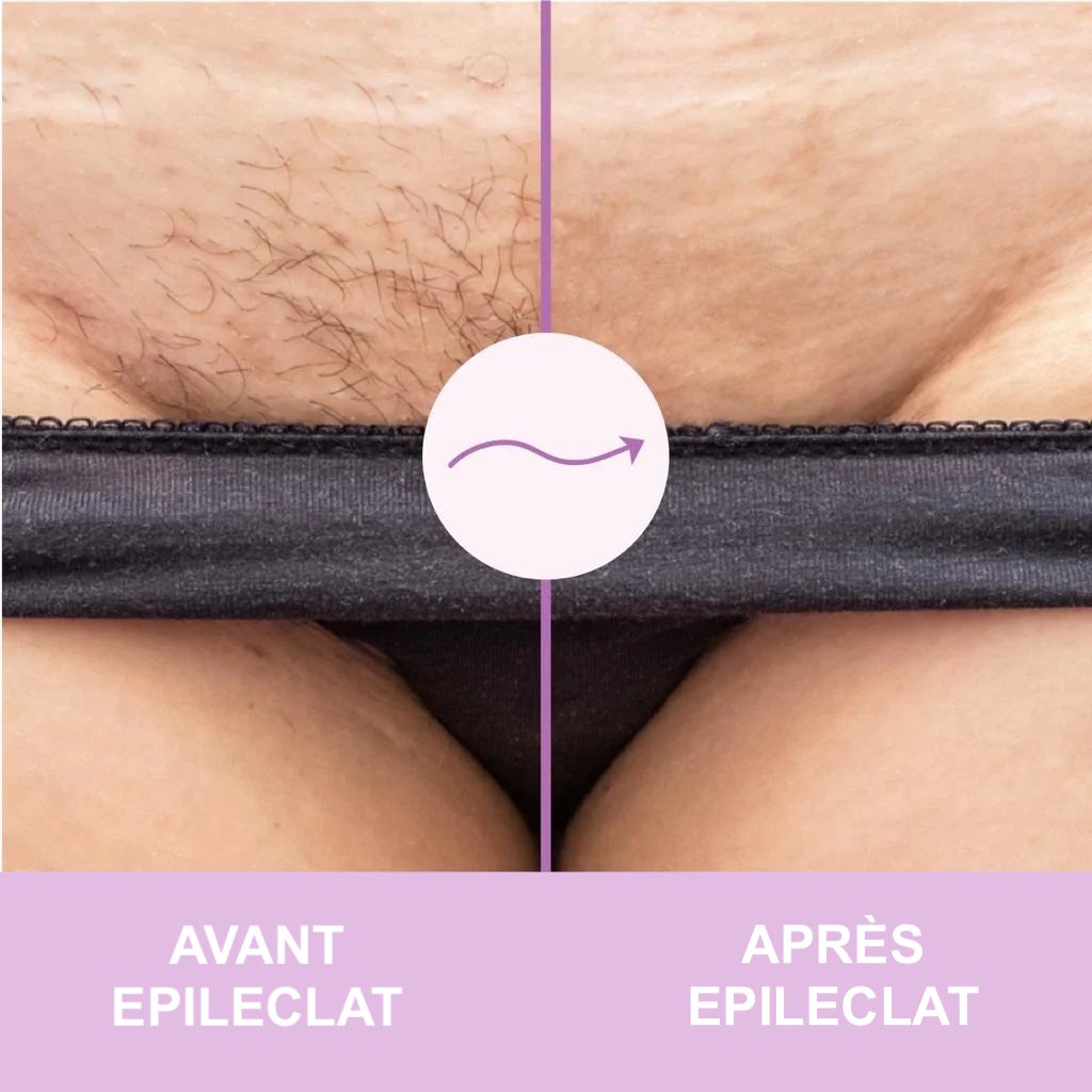 EPILECLAT™ 