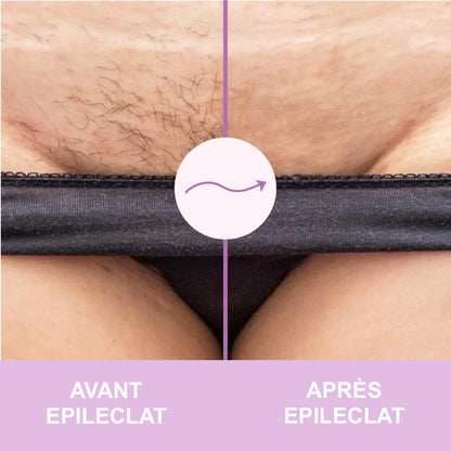 EPILECLAT™ 